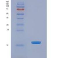 人激素敏感性脂肪酶(LIPE)重组蛋白