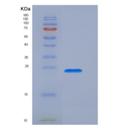 人转化受体电位阳离子通道亚家族V成员1(TRPV1)重组蛋白