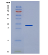 人纤溶酶原(Plg)重组蛋白