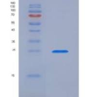 小鼠皮屑蛋白样蛋白1(LEPREL1)重组蛋白