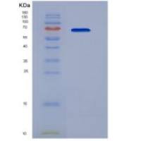 小鼠70kDa热休克蛋白1B(HSPA1B)重组蛋白