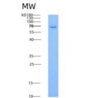 人Coagulation Factor XI / FXI / F11重组蛋白His tag