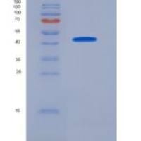 大鼠钠/葡萄糖协同转运蛋白2(SGLT2)重组蛋白