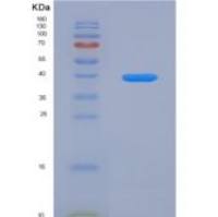 大鼠无翅型MMTV整合位点家族成员4(WNT4)重组蛋白