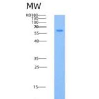 人HPRG / HRG重组蛋白His tag