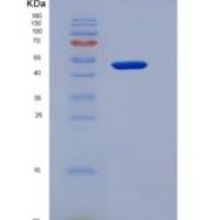 人Cholinergic Receptor, Nicotinic, Gamma (CHRNg)重组蛋白