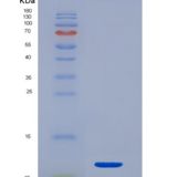 人降钙素原(PCT)重组蛋白