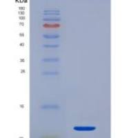 人降钙素原(PCT)重组蛋白
