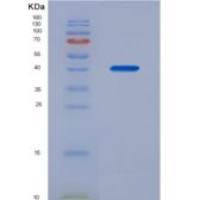 小鼠铁氧还蛋白1(FDX1)重组蛋白