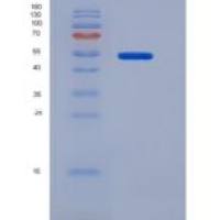 人SIRP alpha重组蛋白