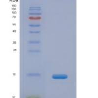 人高尔基糖蛋白1(GLG1)重组蛋白