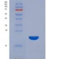 人43kDa Tar DNA结合蛋白(TDP43)重组蛋白