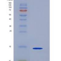 人Thy1细胞表面抗原(CD90)重组蛋白