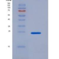 人分泌型磷蛋白2(SPP2)重组蛋白