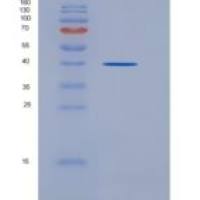 小鼠无翅型MMTV整合位点家族成员5A(WNT5A)重组蛋白