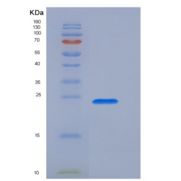 人转化受体电位阳离子通道亚家族V成员1(TRPV1)重组蛋白