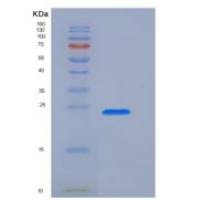 人转化受体电位阳离子通道亚家族V成员1(TRPV1)重组蛋白