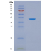 小鼠血管内皮生长因子受体3(VEGFR3)重组蛋白