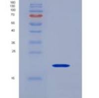 人细胞色素P450家族成员1B1(CYP1B1)重组蛋白