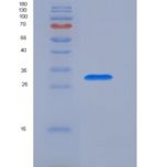 小鼠表面活性物质关联蛋白A(SFTPA1)重组蛋白