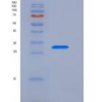 小鼠表面活性物质关联蛋白A(SFTPA1)重组蛋白