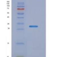 人甲状腺素受体β(THRb)重组蛋白