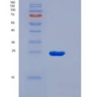 人溶质载体家族30成员8(SLC30A8)重组蛋白