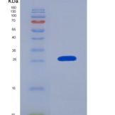 大鼠AGER / RAGE重组蛋白His tag