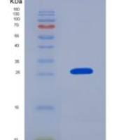 大鼠AGER / RAGE重组蛋白His tag