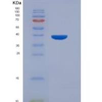 人5-羟色胺转运蛋白(SERT)重组蛋白