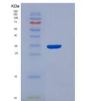 人芳香烃受体(AhR)重组蛋白