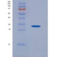 小鼠半乳糖凝集素3(GAL3)重组蛋白