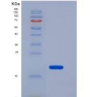 大鼠骨膜蛋白(POSTN)重组蛋白