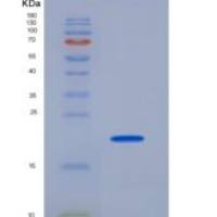 人十七型胶原蛋白重组蛋白