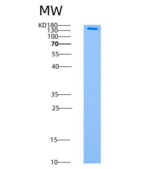 人AMPK (G1/B2/A2) Heterotrimer重