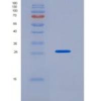 大鼠血红素结合蛋白(HPX)重组蛋白