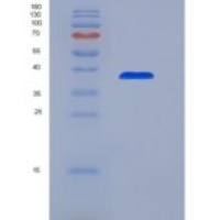 人谷胱甘肽还原酶(GR)重组蛋白