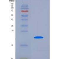 人前列腺酸性磷酸酶(PAP)重组蛋白
