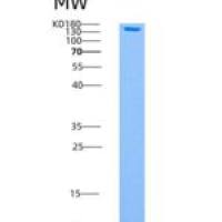 人AMPK (G1/B1/A2) Heterotrimer重组蛋白