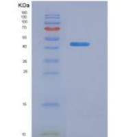 小鼠性别决定区Y框蛋白9(SOX9)重组蛋白