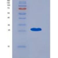 人着丝粒蛋白F(CENPF)重组蛋白