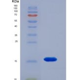人序列相似家族19成员A2(FAM19A2)重组蛋白