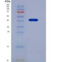 小鼠抵抗素样蛋白β(RETNLb)重组蛋白