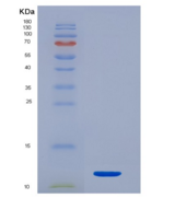 人降钙素原(PCT)重组蛋白