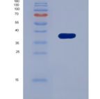人干扰素诱导蛋白35(IFI35)重组蛋白