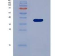 人干扰素诱导蛋白35(IFI35)重组蛋白