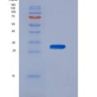 人微管关联蛋白τ(MAPT)重组蛋白
