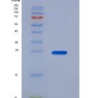 人癌胚抗原(CEA)重组蛋白
