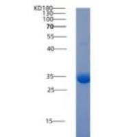 人转化生长因子β受体Ⅰ(TGFbR1)重组蛋白