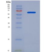 人蛋白激酶Cθ(PKCq)重组蛋白